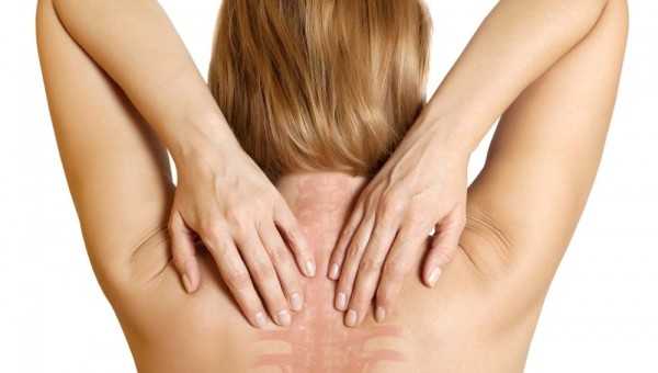 osteoporosi